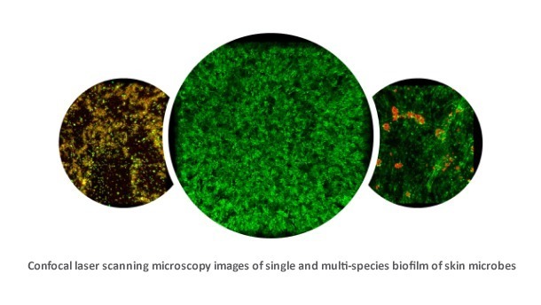 Loreal_Confocal-laser-scanning