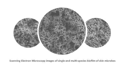 Loreal_Scanning-Electron-Microscopy-480x271