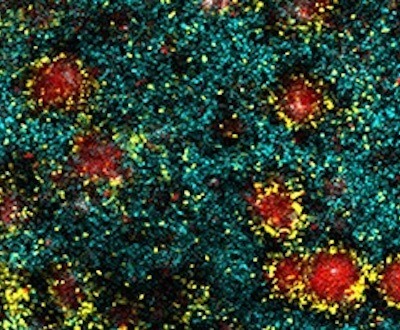 biofilm-biology-mechanisms